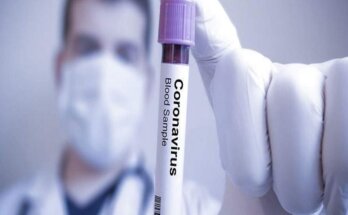 Δωρεάν rapid test